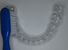 Orthodontic invisible retainer 2
